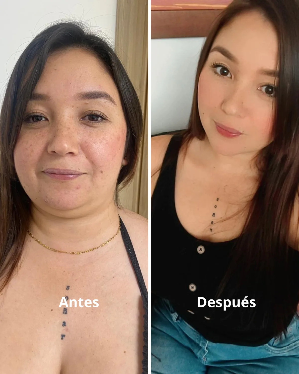 Antes y después · Diana